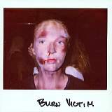 burnvictim1.jpg