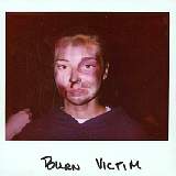 burnvictim2.jpg